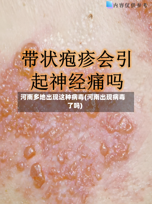 河南多地出现这种病毒(河南出现病毒了吗)-第2张图片