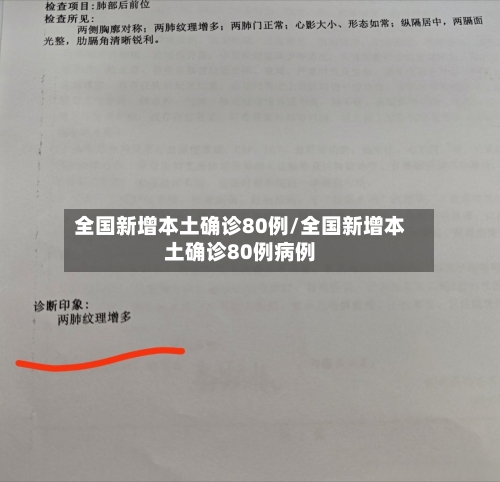 全国新增本土确诊80例/全国新增本土确诊80例病例-第3张图片