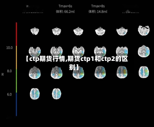 【ctp期货行情,期货ctp1和ctp2的区别】